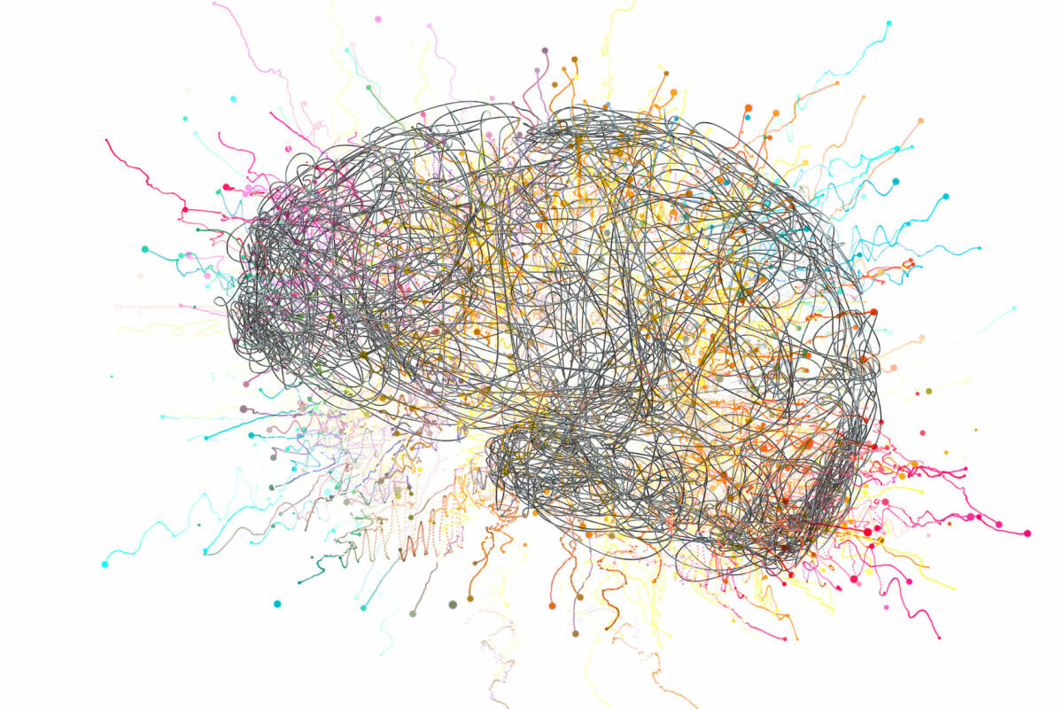 Illustration eines überangestrengten Gehirns © TUMEGGY/SCIENCE PHOTO LIBRARY / Getty Images